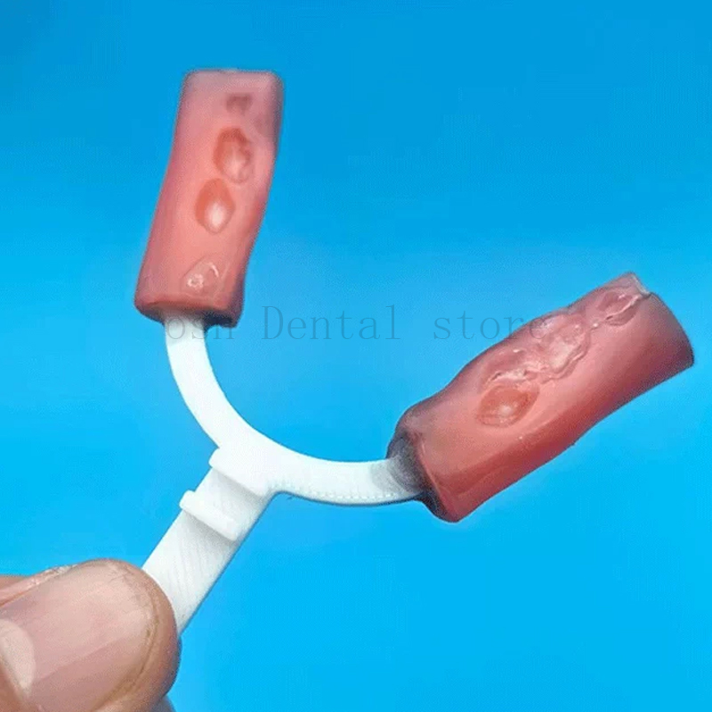 10 unidades/embalagem, garfo d - 3D Printing Orthodontics avaliação e preço