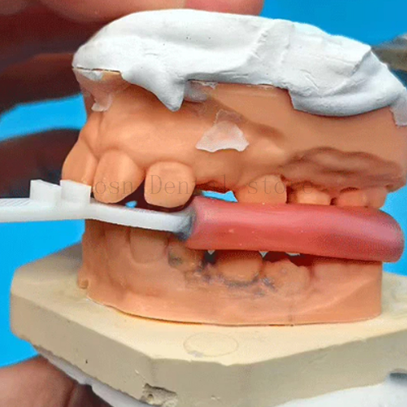 10 unidades/embalagem, garfo d - 3D Printing Orthodontics avaliação e preço