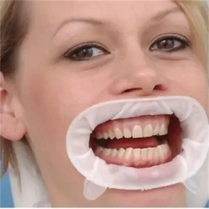 Abridor Bucal Odontológico Opt - 3D Printing Orthodontics avaliação e preço